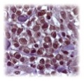 Anti-infective Image